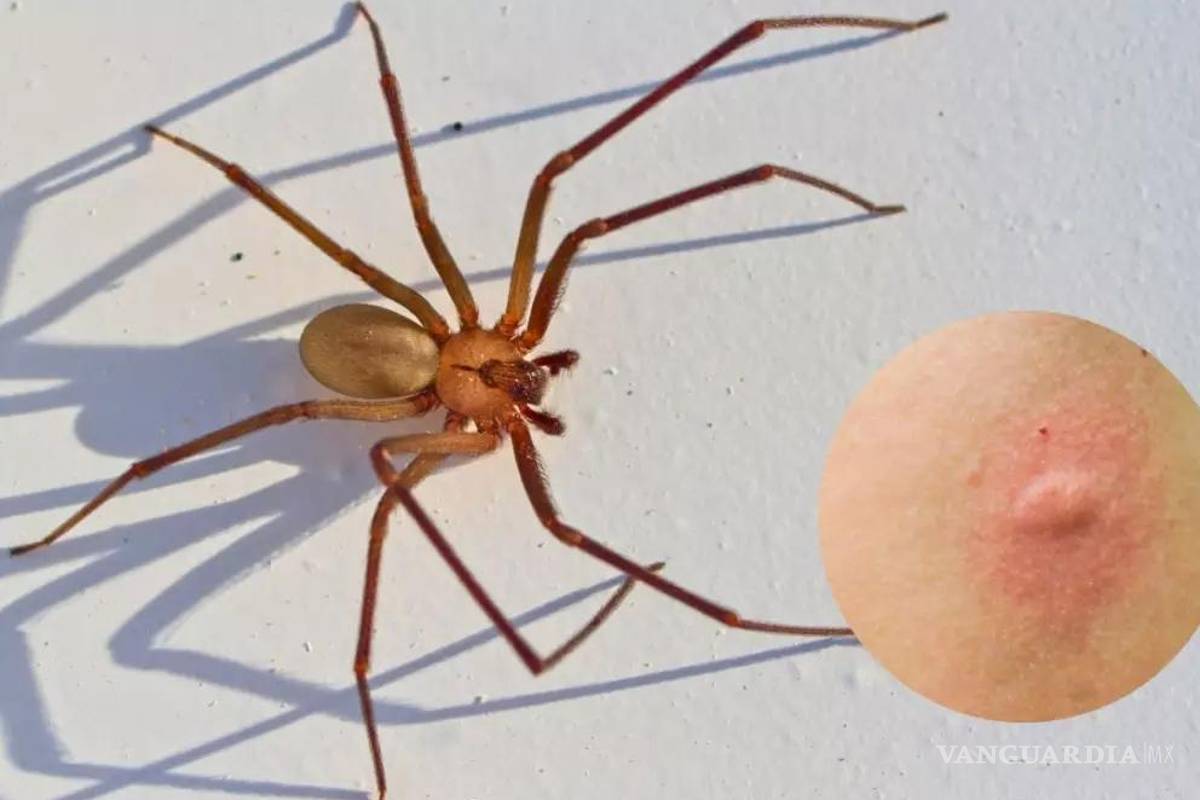 Ataques de araña violinista se disparan un 55% respecto a 2024 en Coahuila