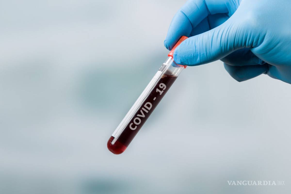 ¿Se puede aprender algo del COVID-19?