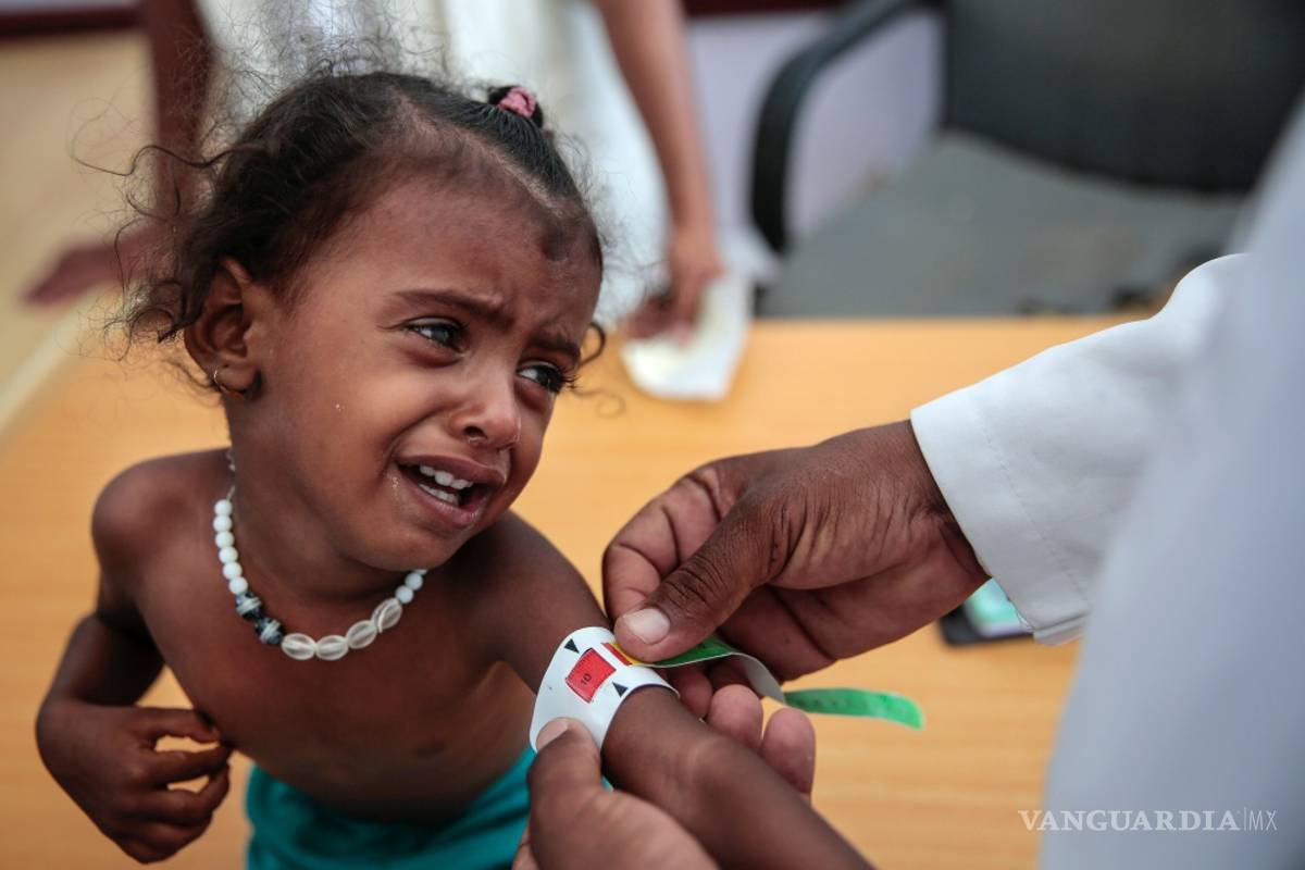 $!Según Save the Children, el hambre habría matado a 85 mil niños en Yemen