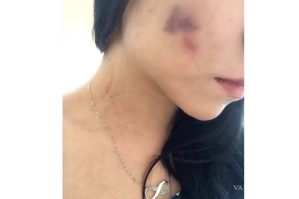 ‘En octubre iniciaron las agresiones’: Porrista de los Saraperos de Saltillo, golpeada por su novio
