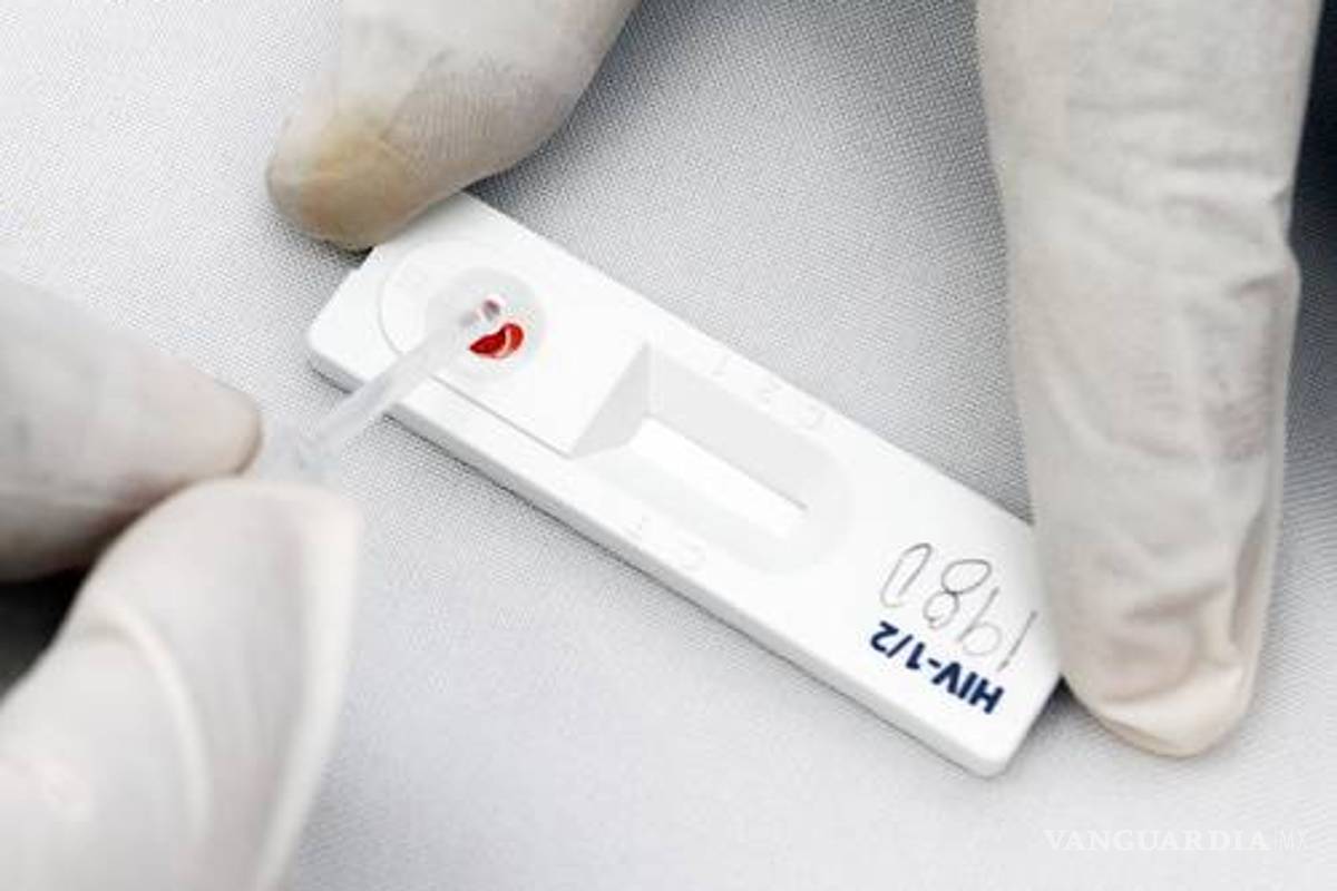 Examen rápido y de bajo costo detecta tuberculosis y VIH al mismo tiempo