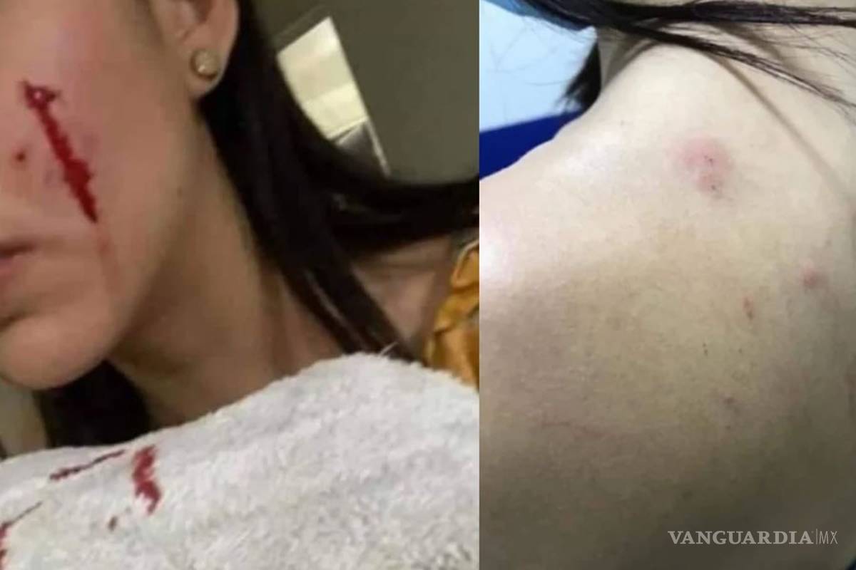 El perro me mordió primero, dice novia de joven que lo mató con hacha, en Sinaloa