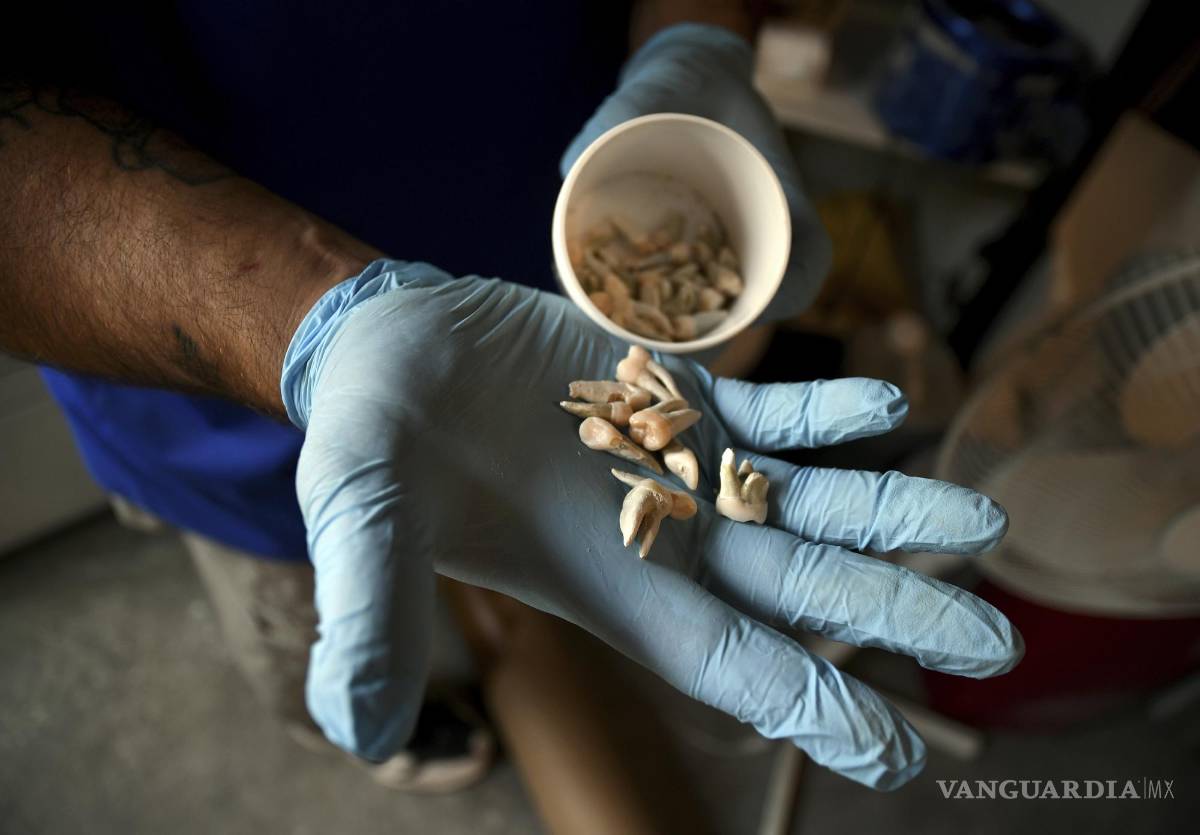 $!En esta foto del miércoles 11 de agosto de 2021, el empleado Chris Olachia muestra un puñado de dientes en las instalaciones de compostaje de cuerpos humanos de The Natural Funeral en Arvada, Colorado. AP/Thomas Peipert