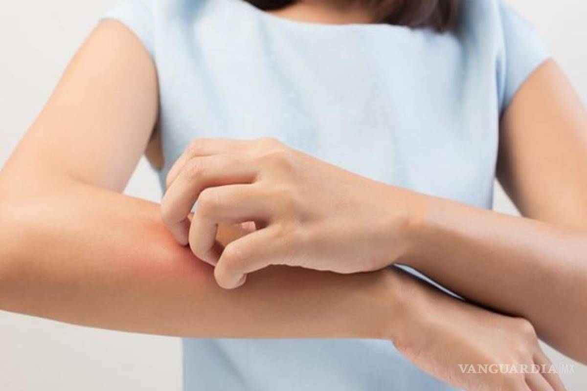 Esta es la razón científica de por qué los mosquitos te pican