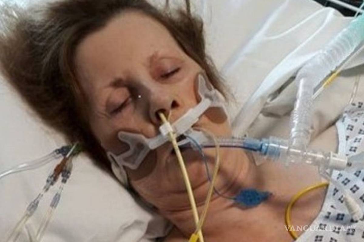 Una mujer estuvo entre la vida y la muerte por un arañazo de su gato