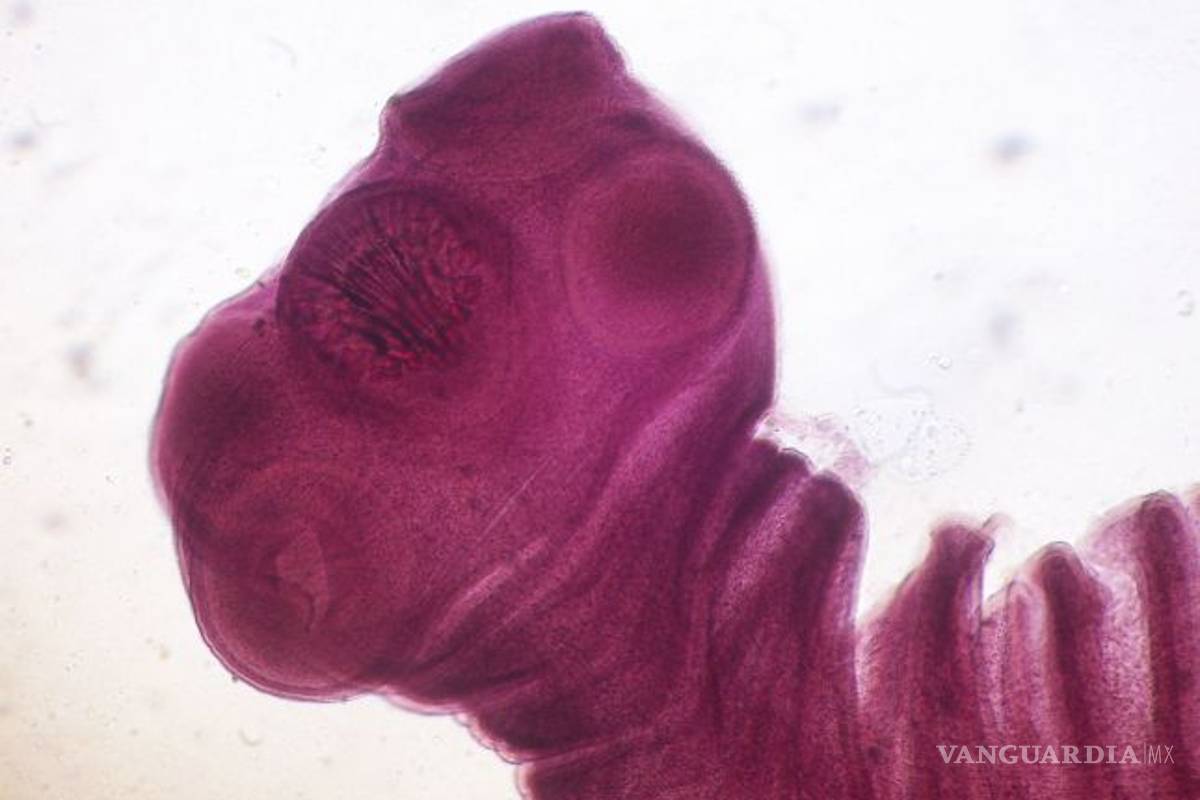 Un insecto le comía el cerebro desde hace 15 años