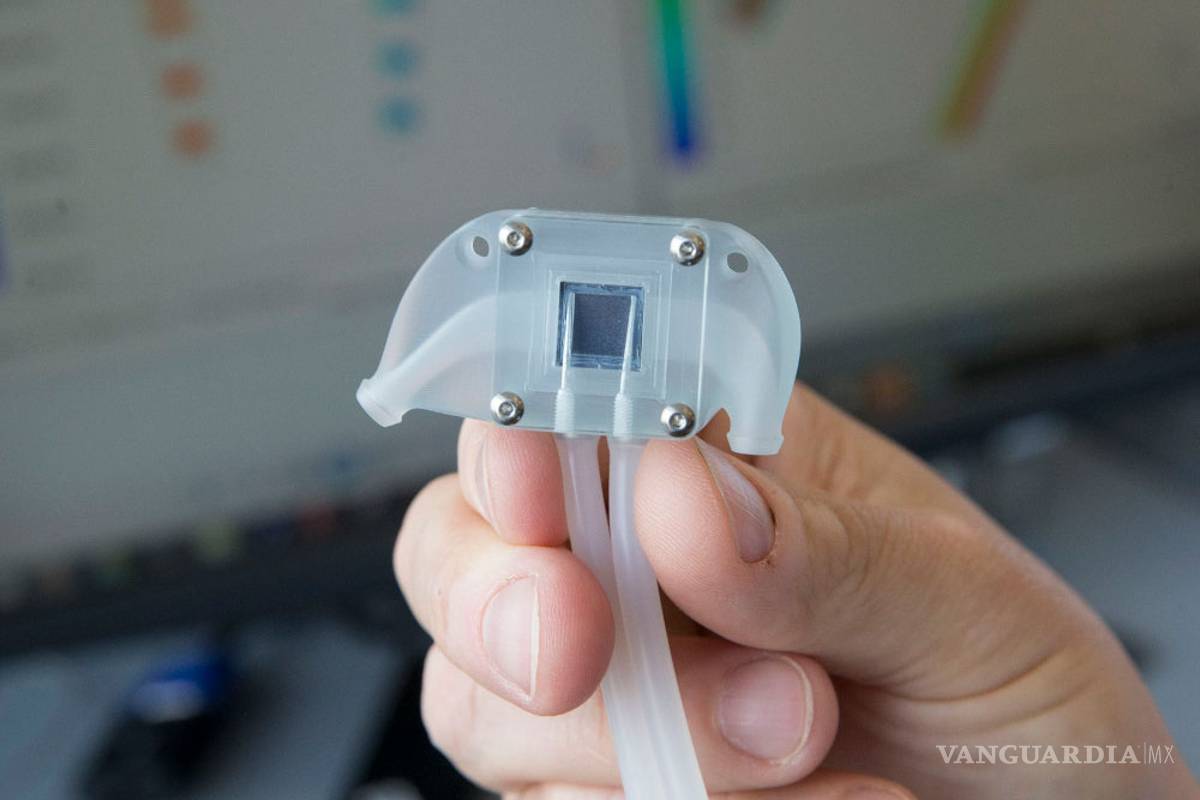 Llegó el riñón biónico