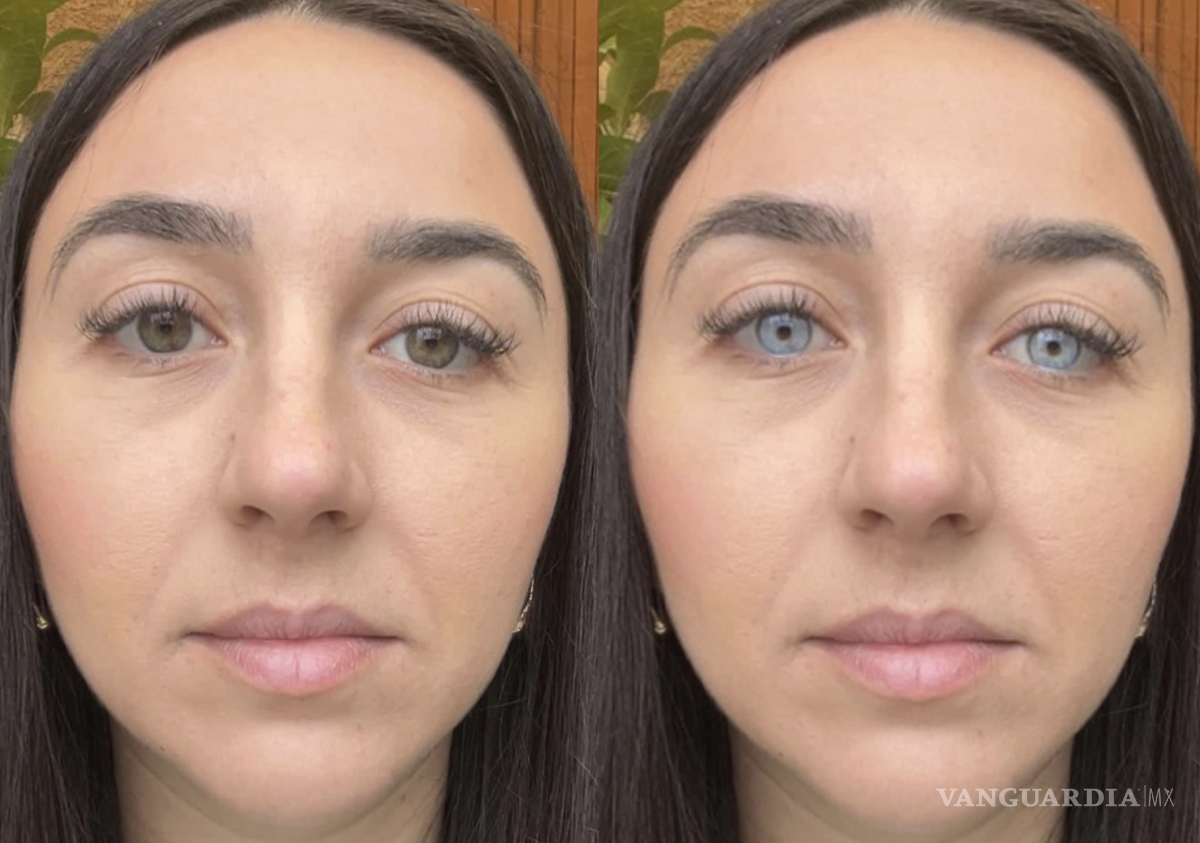 $!Los oftalmólogos alertan que estas cirugías pueden causar daños permanentes en la vista.