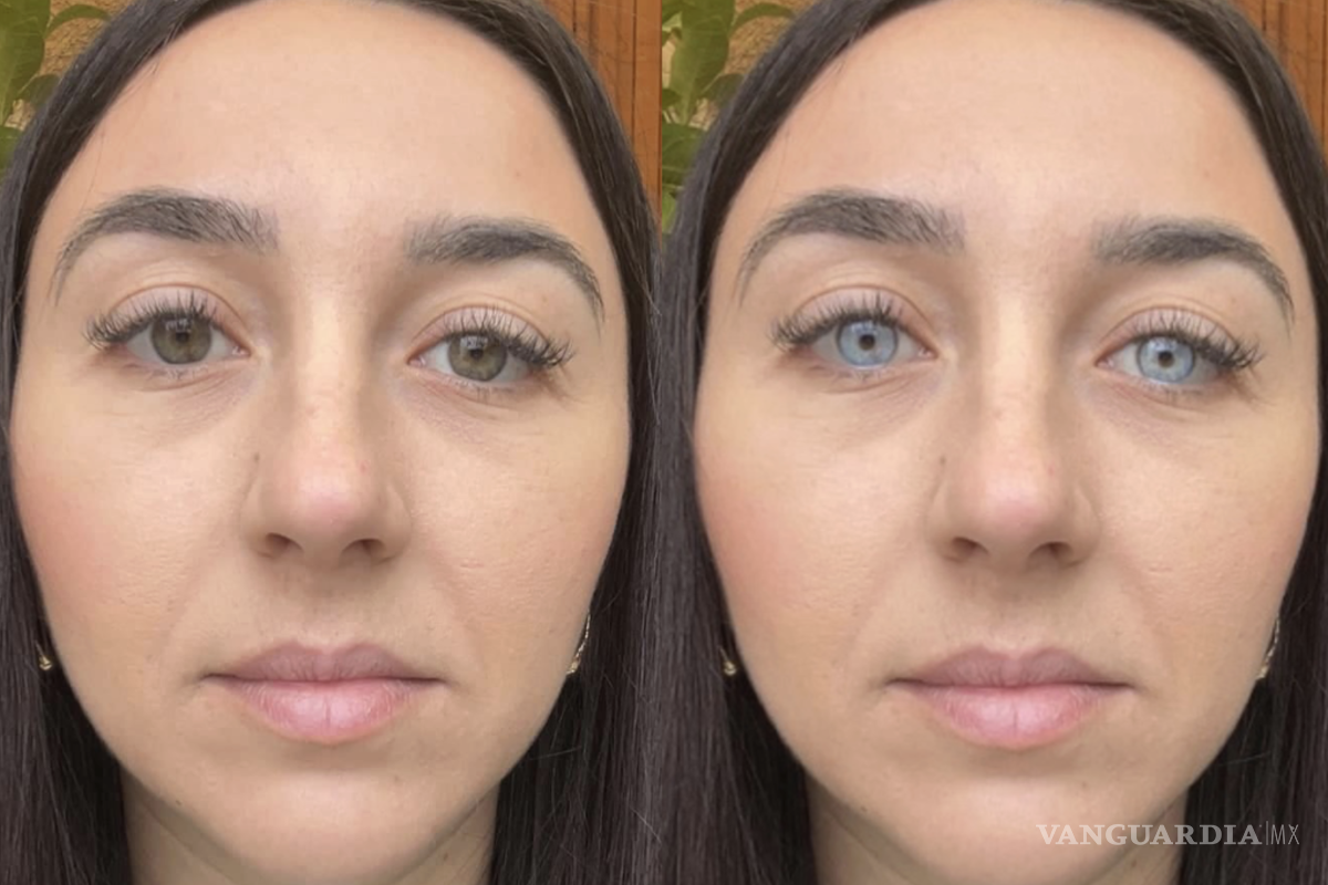 $!Los oftalmólogos alertan que estas cirugías pueden causar daños permanentes en la vista.