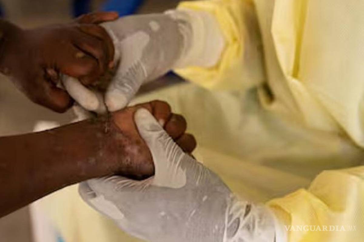 La OMS declara emergencia sanitaria internacional por la viruela del mono; lo que implica