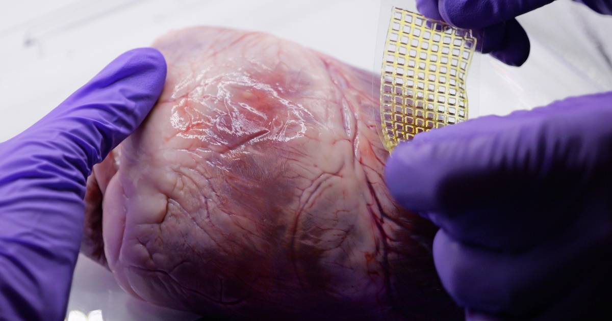 Desarrollan una ‘curita’ que es capaz de reparar el corazón