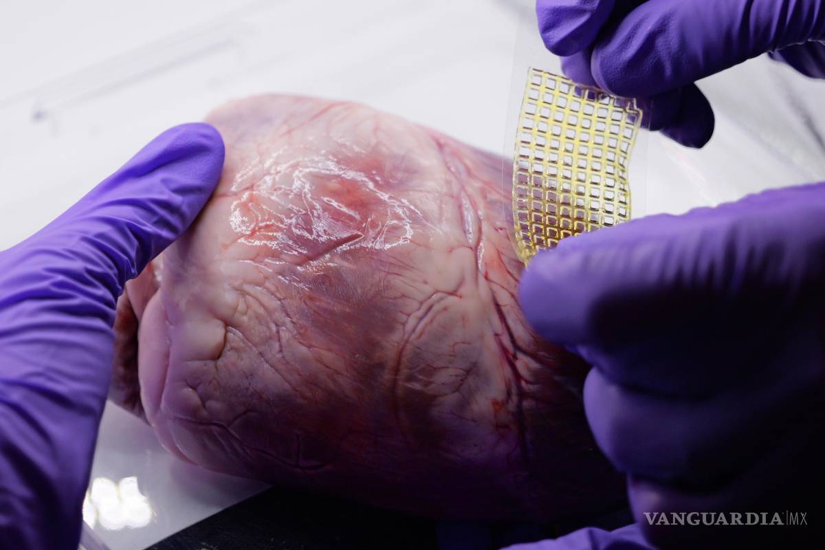 Desarrollan una ‘curita’ que es capaz de reparar el corazón