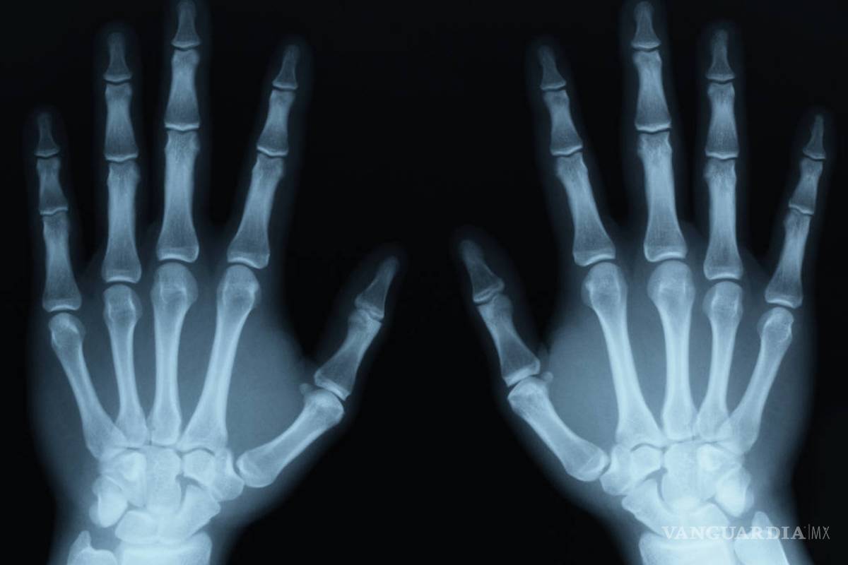 Porque no deberías tronarte los dedos