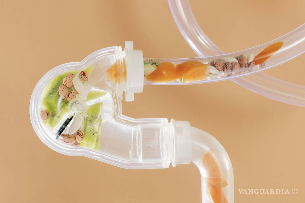 ¿Es posible curar el estreñimiento sin laxantes?