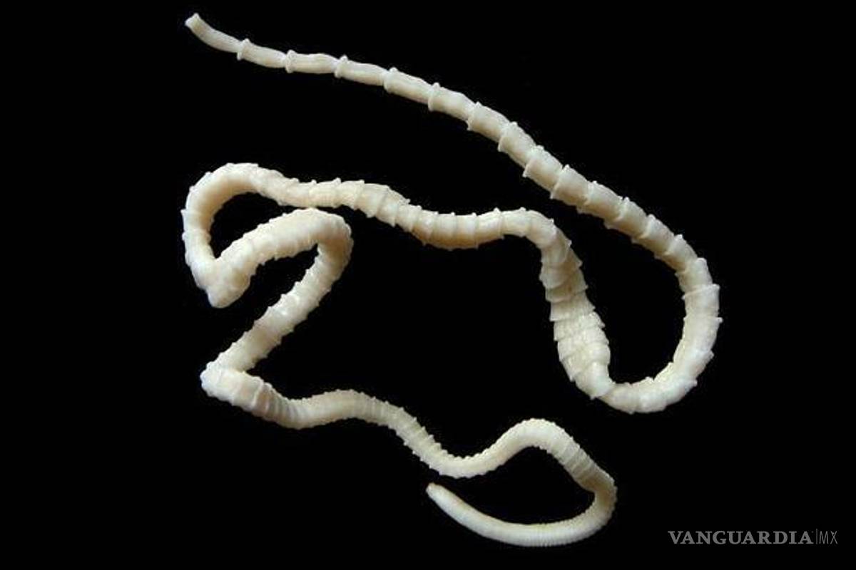 Le encuentran 700 gusanos en el cuerpo a un hombre, por comer carne poco cocida