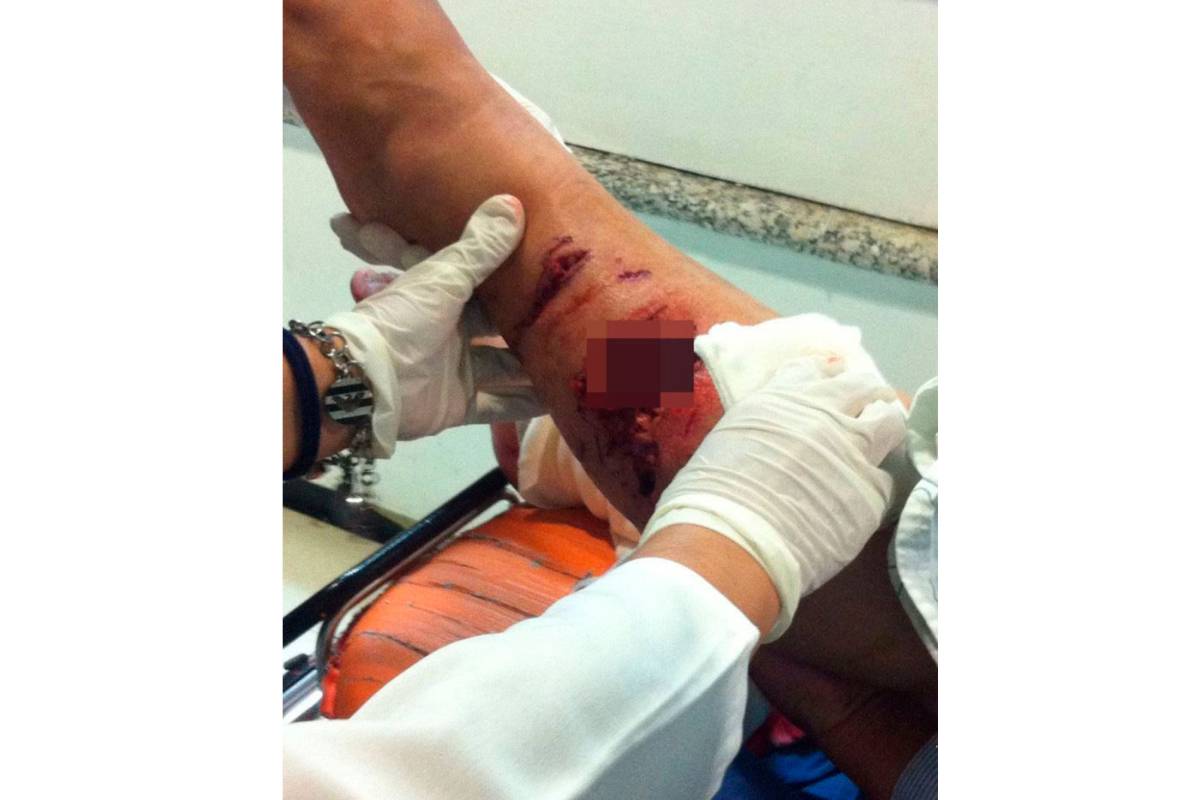 'Raza pitbull es satanizada por los medios de comunicación'