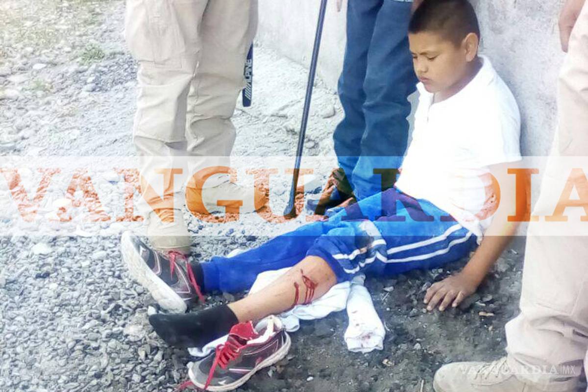 $!Pitbull ataca a niño de 11 años en Saltillo