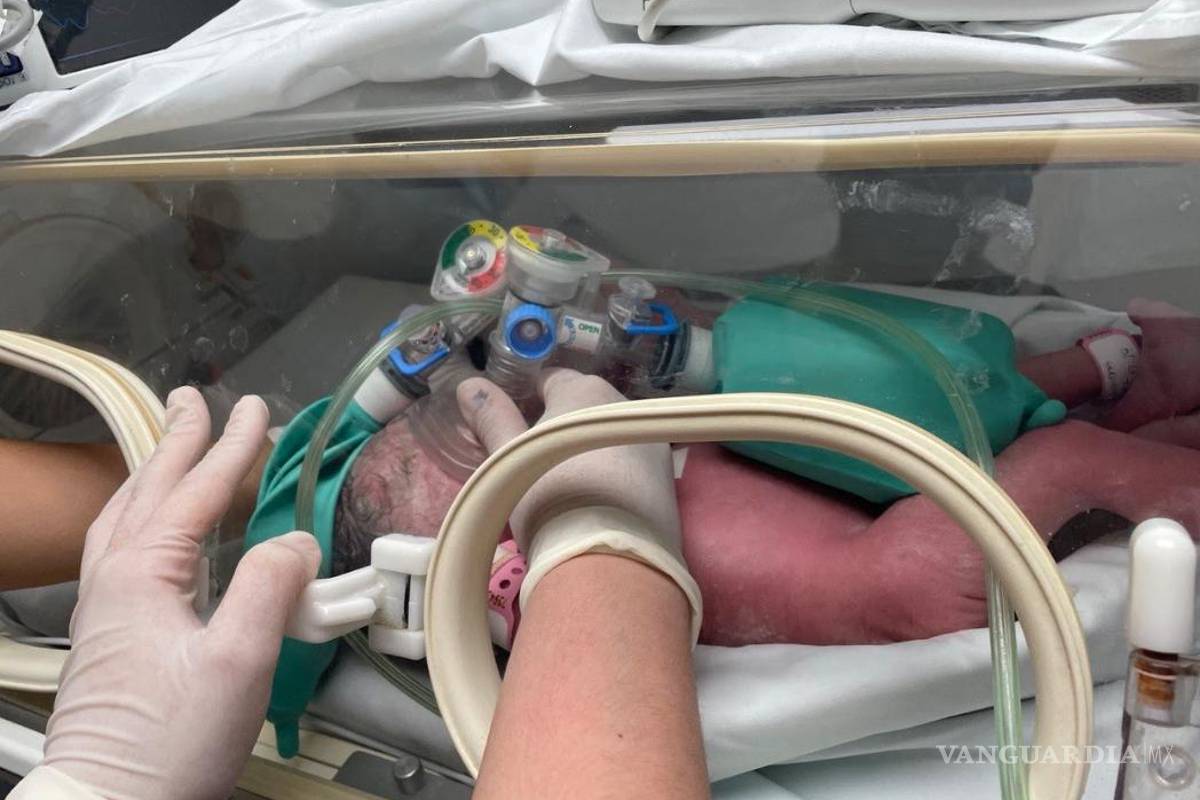 Separan a siamesas en Nuevo León; reportan gravedad en una de las recién nacidas