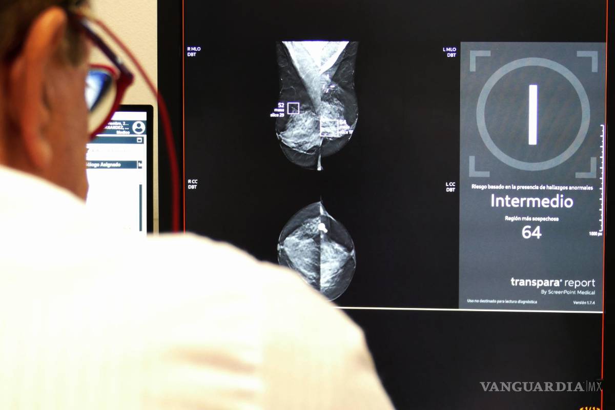 $!Imagen de la estadificación de riesgo de una mamografía a través de IA (mensaje a la derecha), en esta se marca la masa sospechosa encuadradas en violeta.
