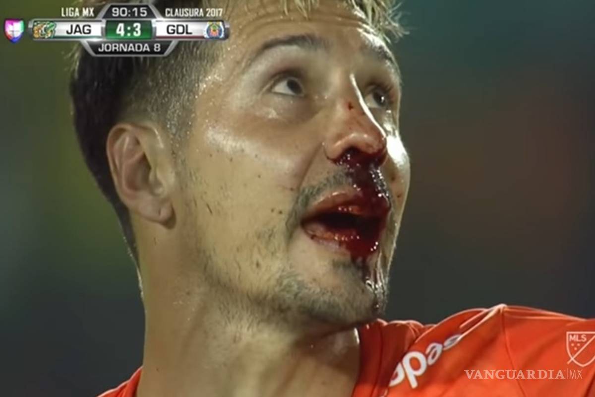 La fractura de Jonathan Fabbro por el codazo de Pereira