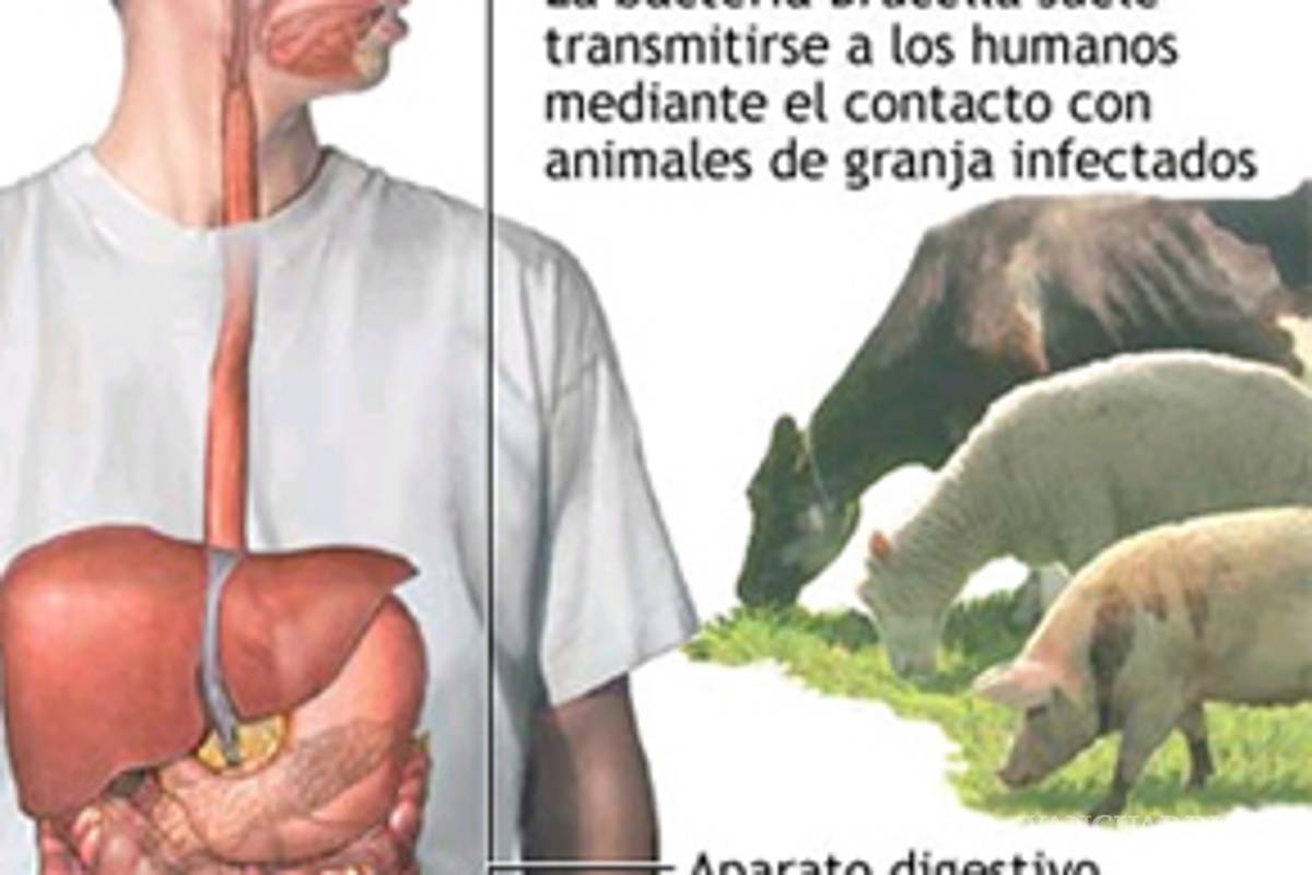 Declaran alerta sanitaria por fiebre de malta