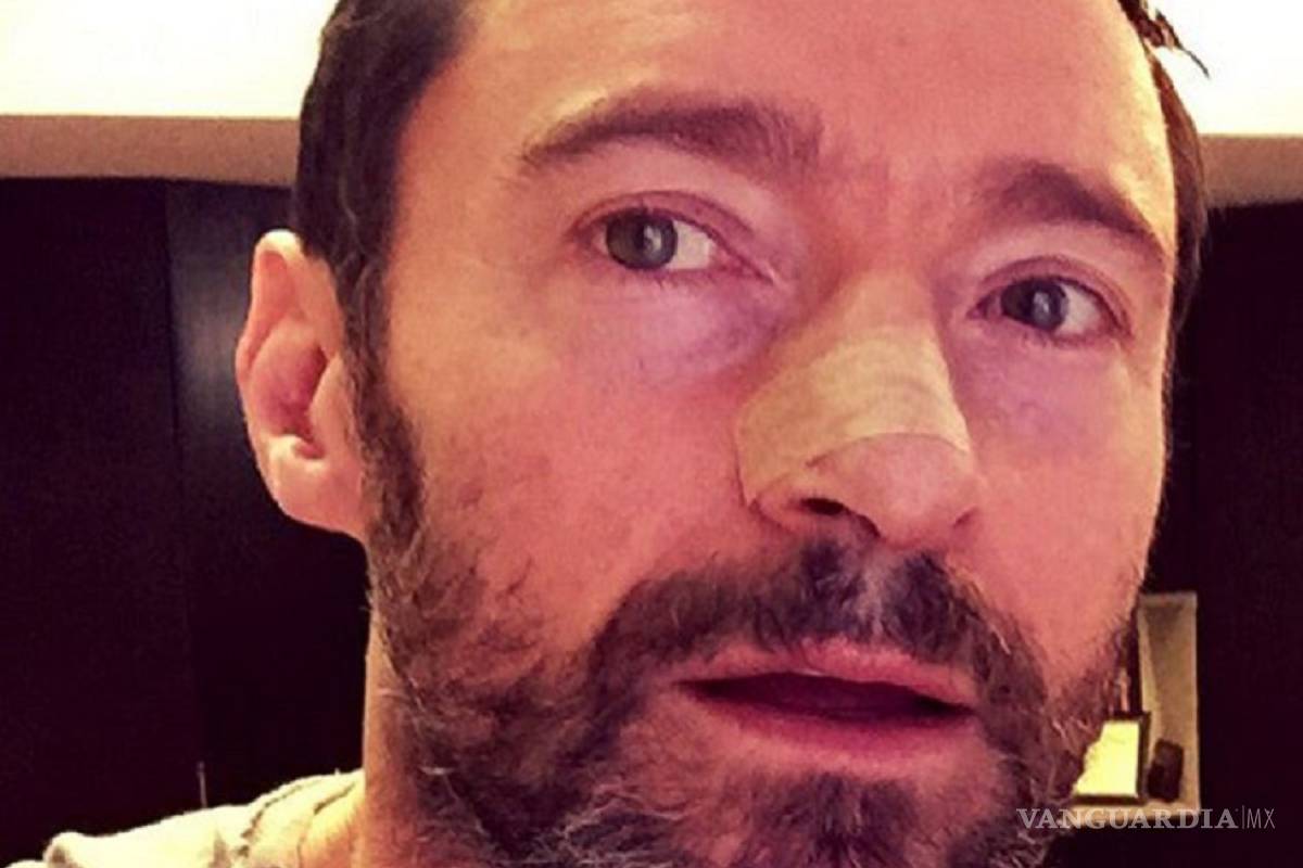 Hugh Jackman, intervenido por quinta vez de cáncer de piel