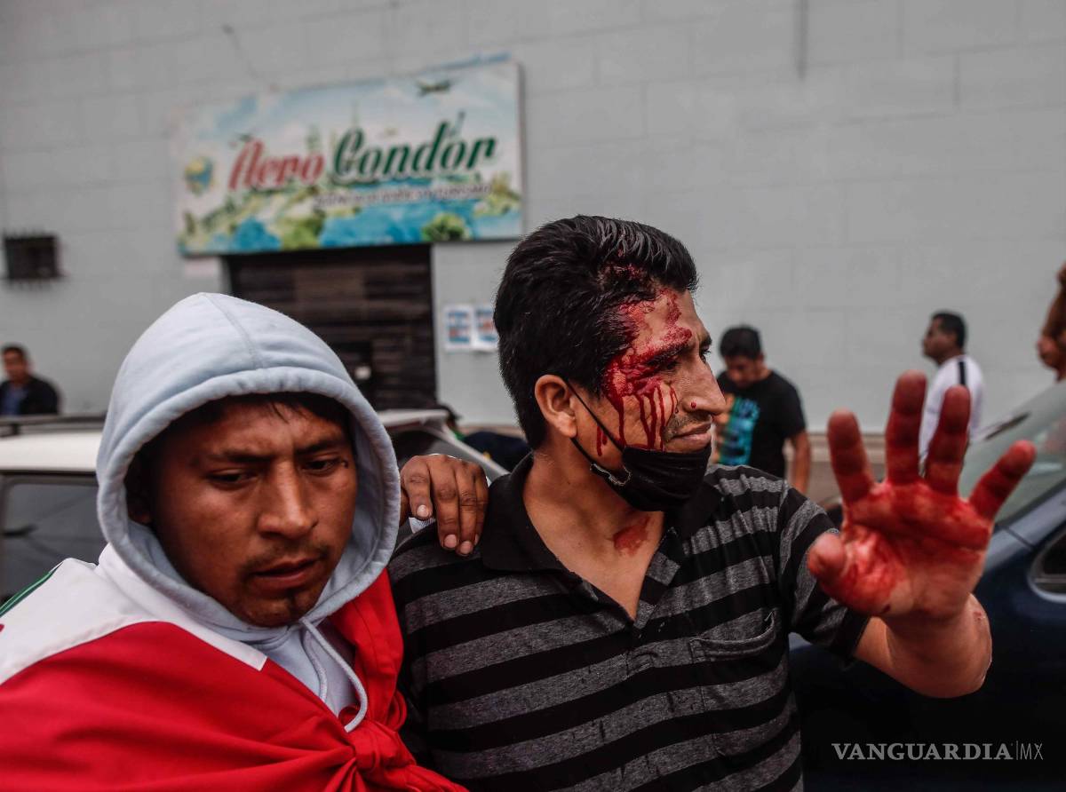 $!Un hombre herido permanece afuera de la Prefectura de Lima, donde permanece detenido el ahora expresidente Pedro Castillo.