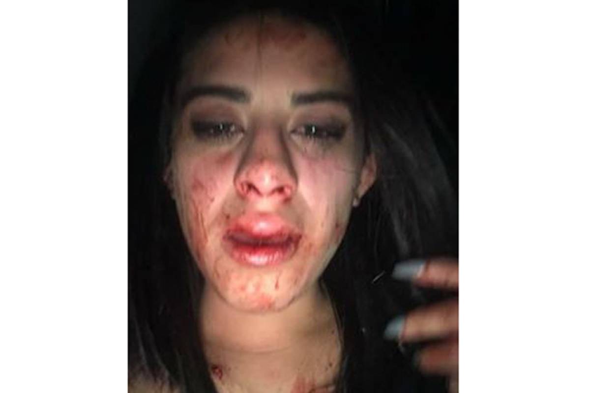 Denuncia mujer, fuerte agresión de hijo de conductor de Televisa Saltillo