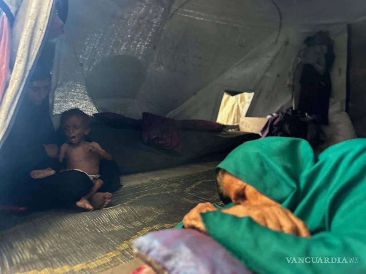 $!En la imagen, un niño desnutrido en Gaza.