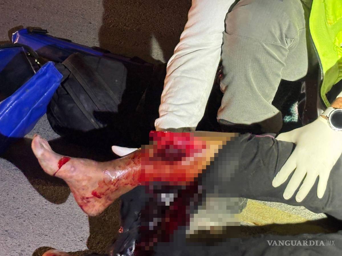 $!La mujer sufrió una fractura expuesta en la pierna derecha a causa del impacto del vehículo.