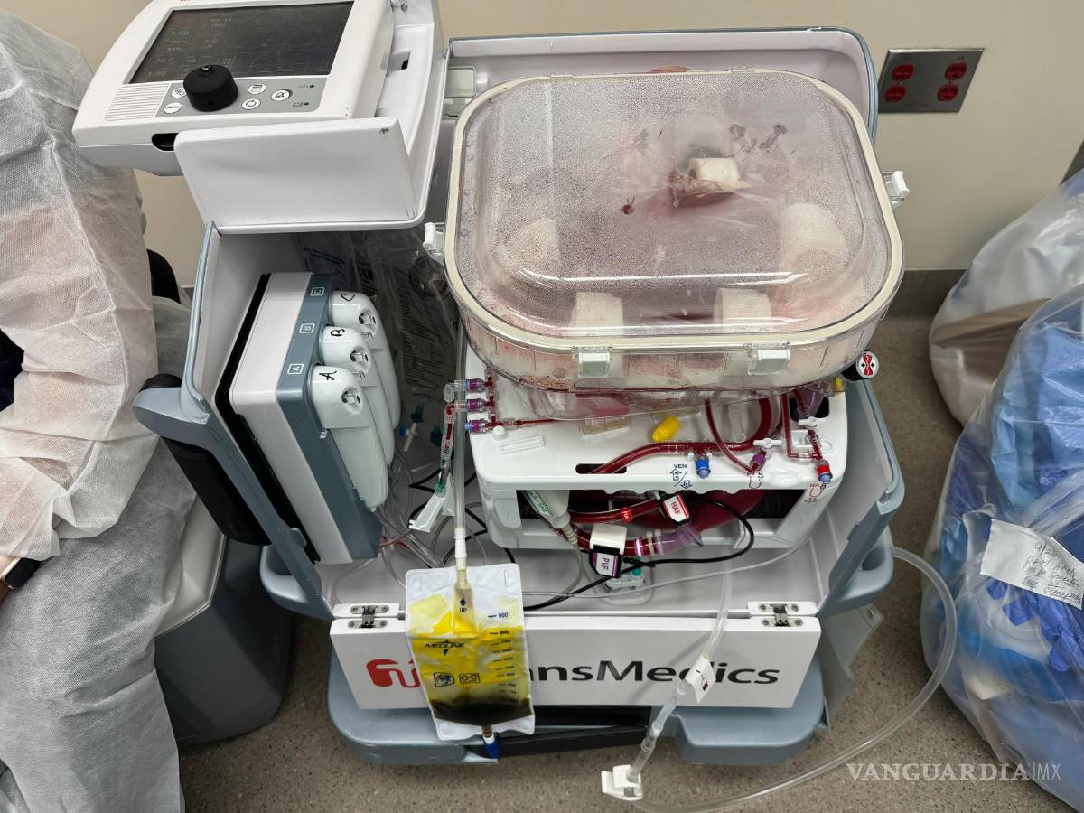 $!Una máquina de perfusión que contiene un hígado de un donante fallecido.