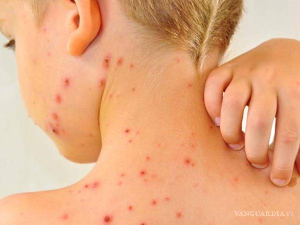 $!Personal médico acudió esta semana a la primaria de Huachichil para aplicar vacunas contra el sarampión, aunque no alcanzaron para todos los alumnos.