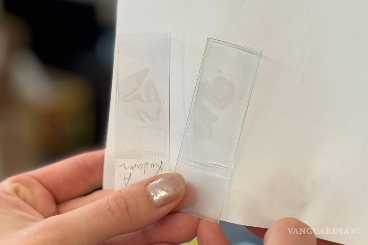 $!En la diapositiva de la izquierda, que contiene tejido cerebral con Alzheimer sin tratamiento. La de la derecha, que contiene tejido cerebral tratado con fármacos.