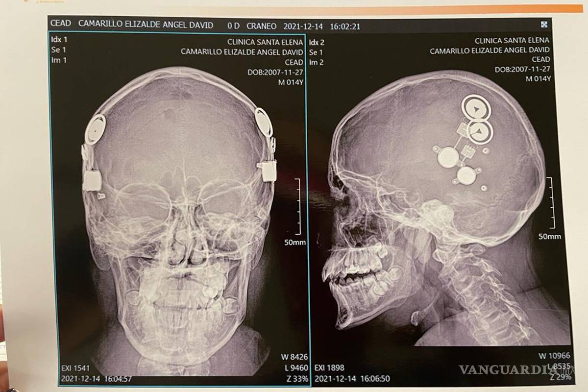 $!Guadalupe Montes, la doctora saltillense que realizó (gratis) una cirugía única en México