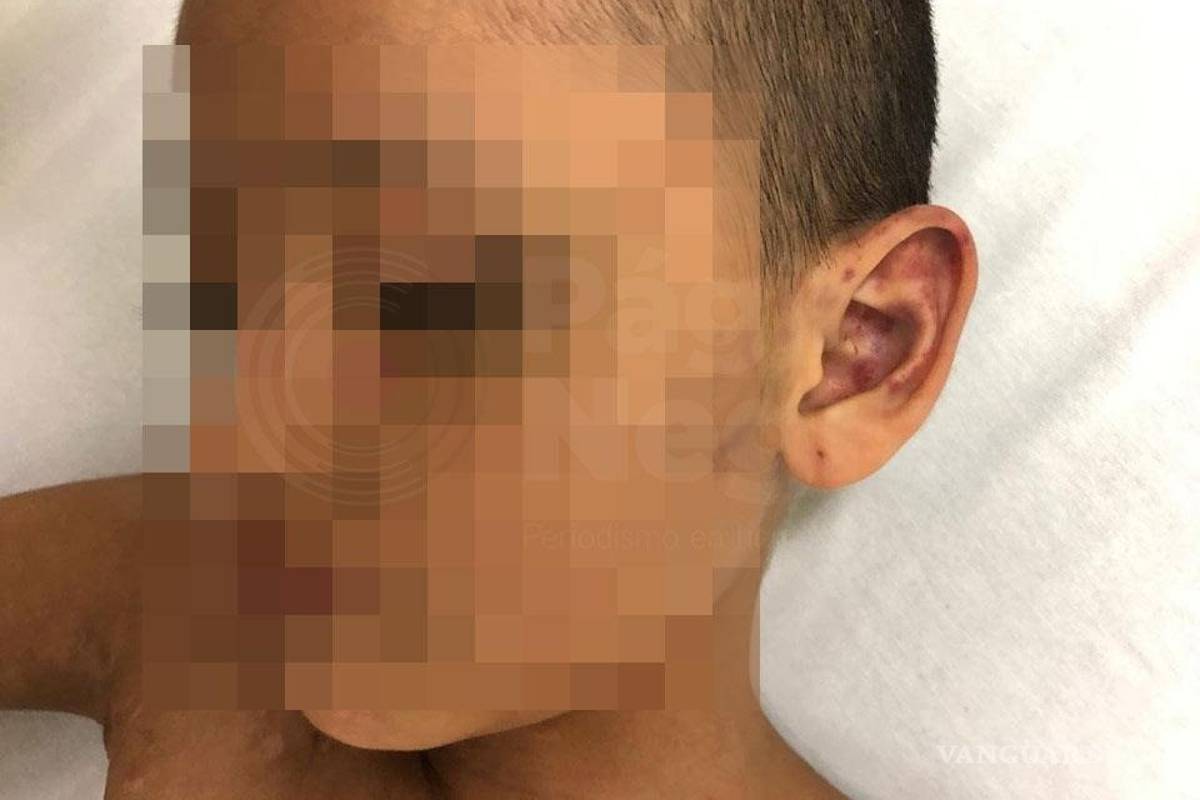 Niña violada pedía a médicos que la dejaran morir; fue operada nuevamente