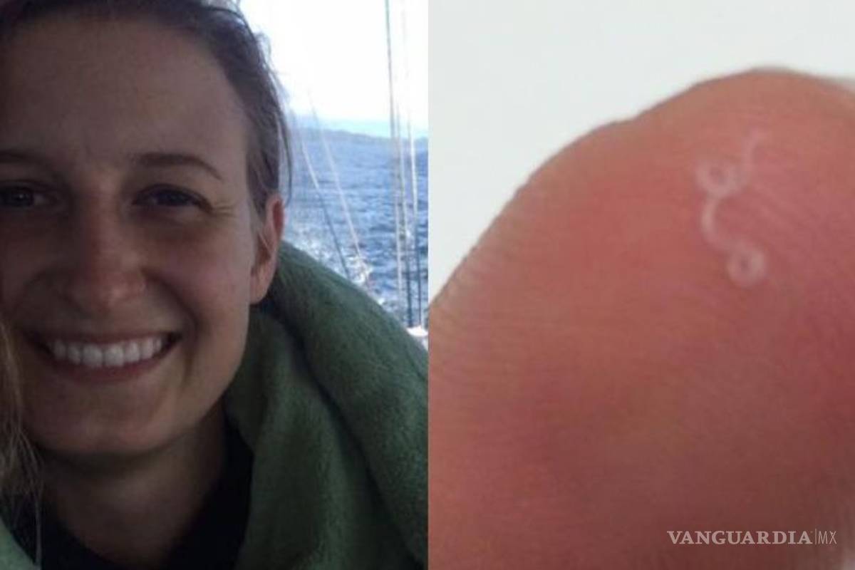 Mujer encuentra catorce gusanos en su ojo izquierdo; es el primer caso en humanos