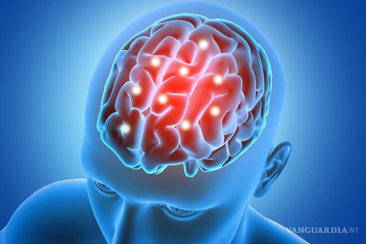 Los ictus leves tienen consecuencias graves, si no se atienden a tiempo