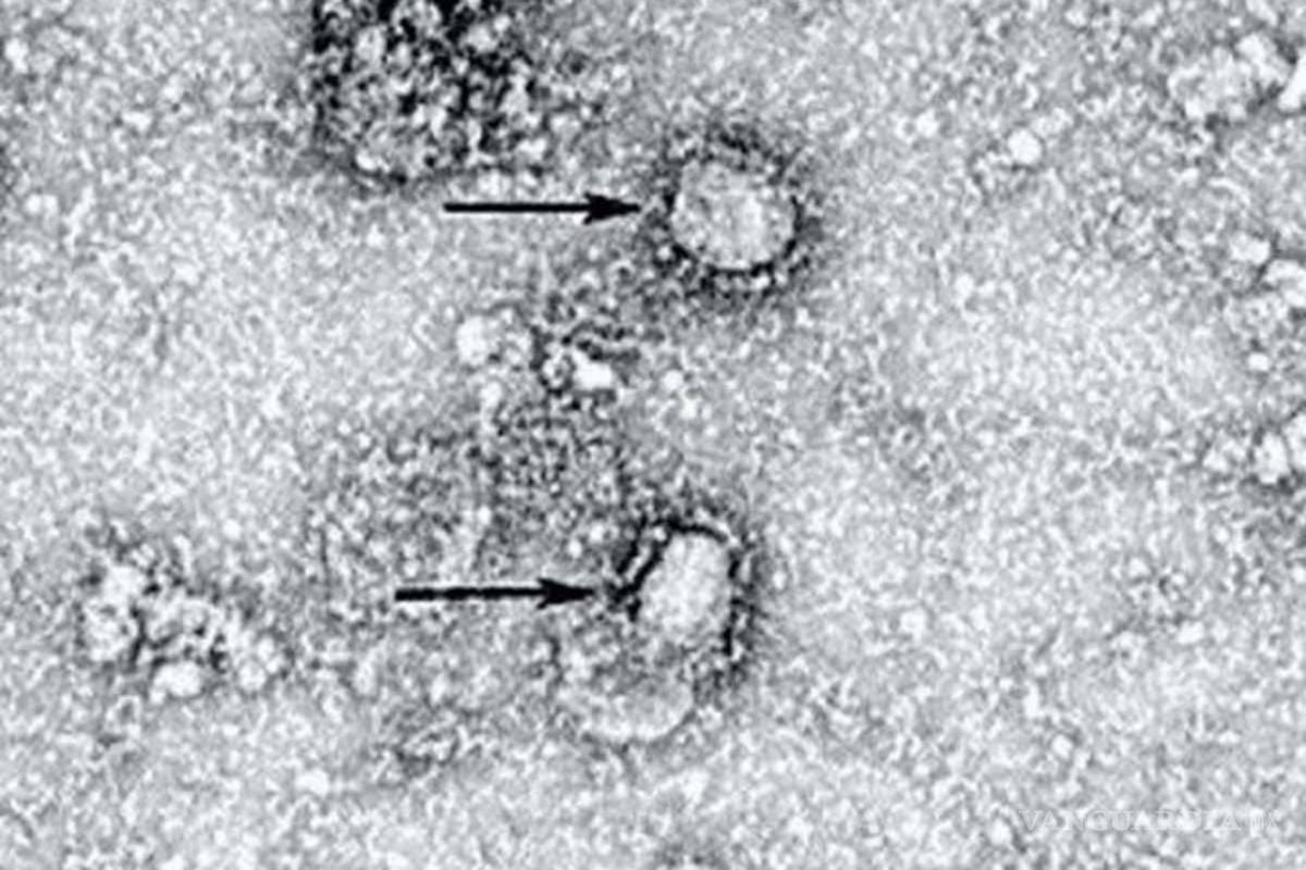 Comparten primera imagen del coronavirus visto desde el microscopio