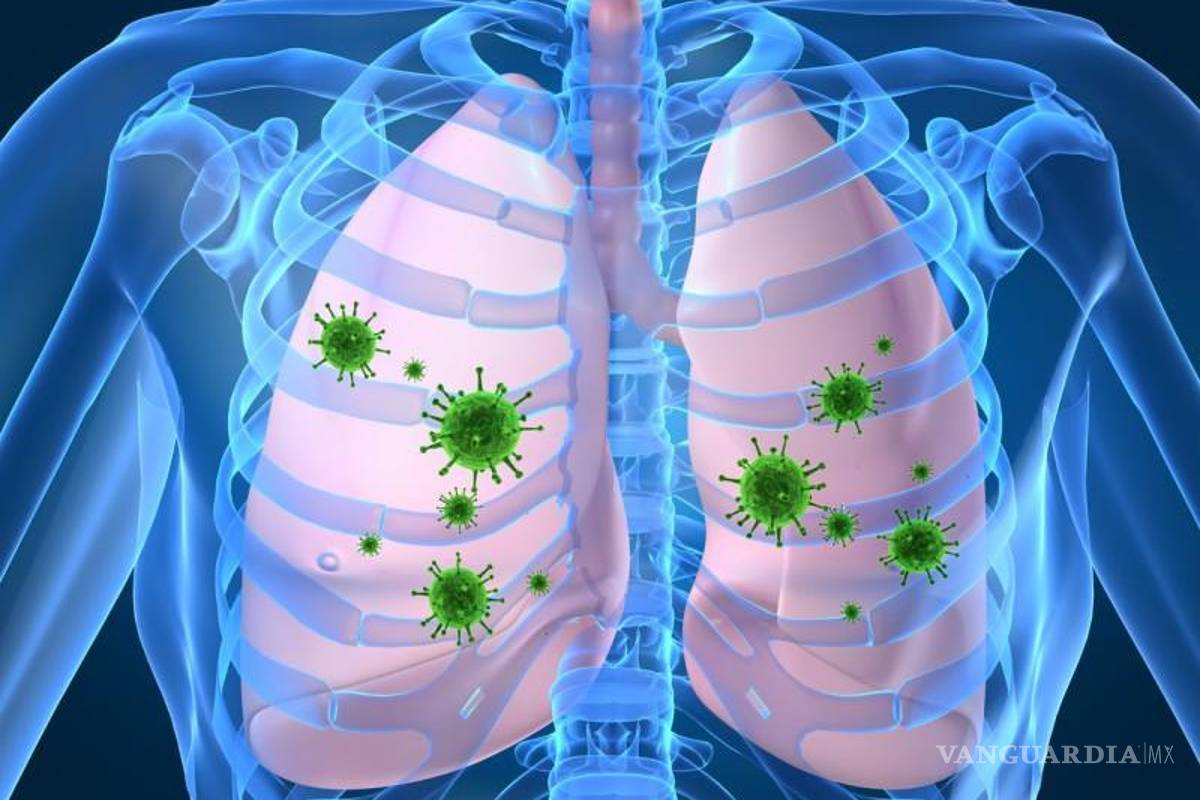 Incluso en verano, Coahuila registró cinco casos de neumonía al día