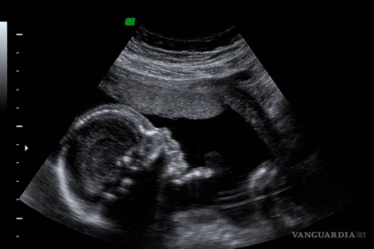 ¿Cuánto cuesta tener un bebé en la CDMX?