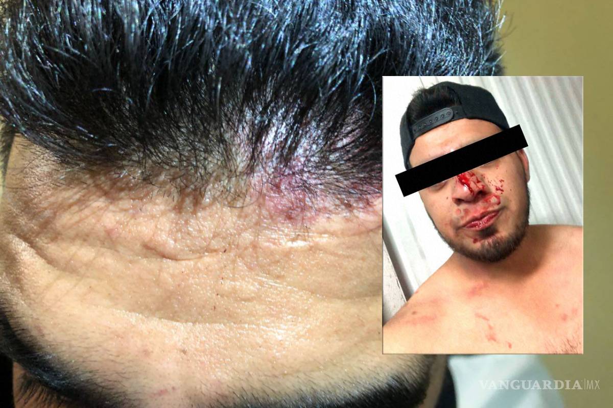 Nuevo escándalo en Monclova: Exnovia le pone trampa, lo lleva a 'emboscada' y se burla de él