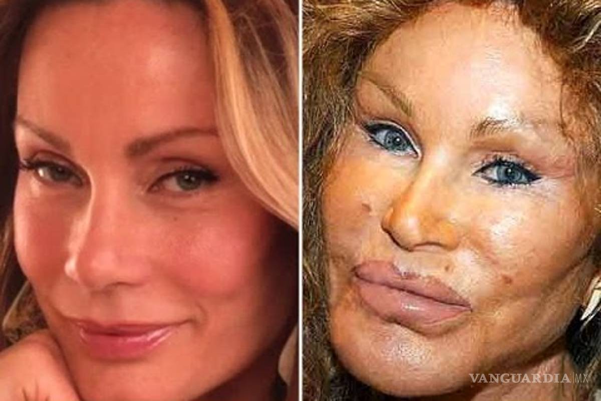 $!¿Una cirugía más? Axl Rose y Mickey Rourke lucen irreconocibles