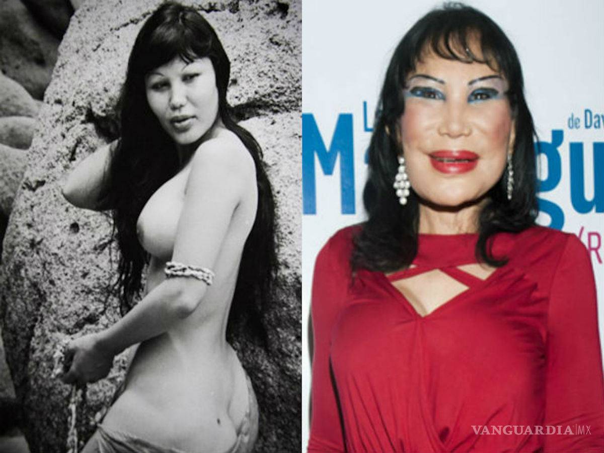 $!No solo es la Guzmán; estas celebridades quedaron peor con sus cirugías