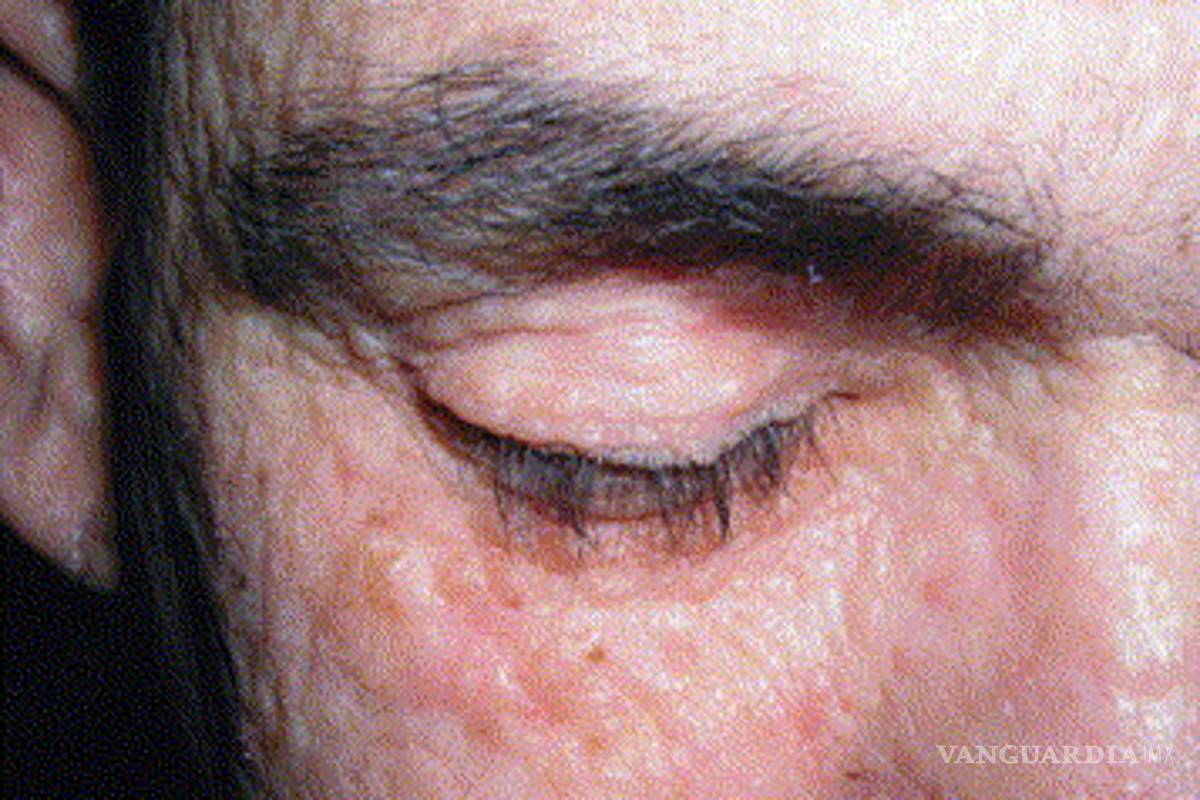 No sentir miedo no es una ventaja, es una enfermedad de cuidado