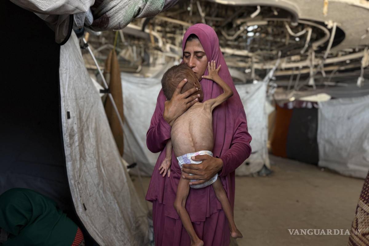 La desnutrición mata a cinco gazatíes, incluido un bebe y 2 niños, en las últimas 24 horas