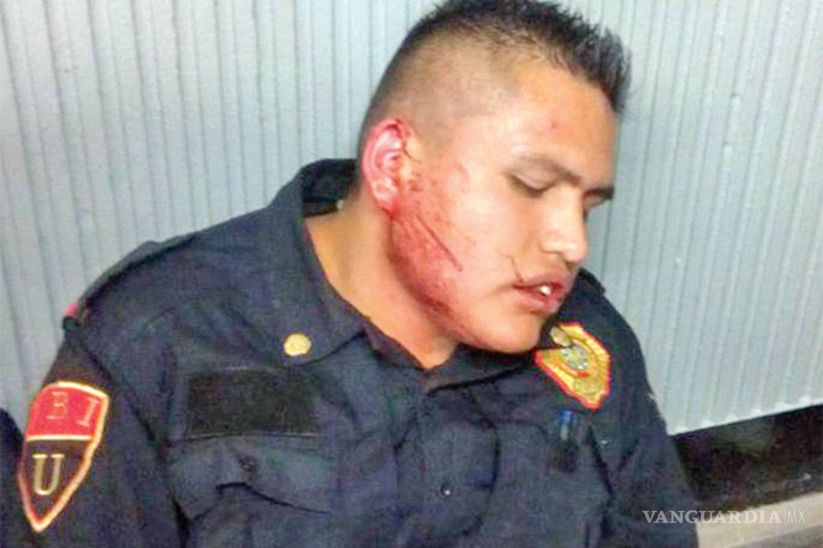 Muerden oreja de policía en la CDMX