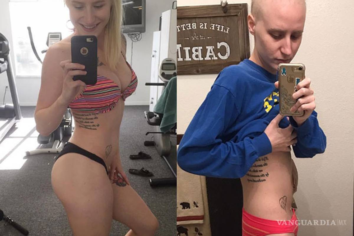 El cáncer no le quita la sonrisa a una belleza del fitness