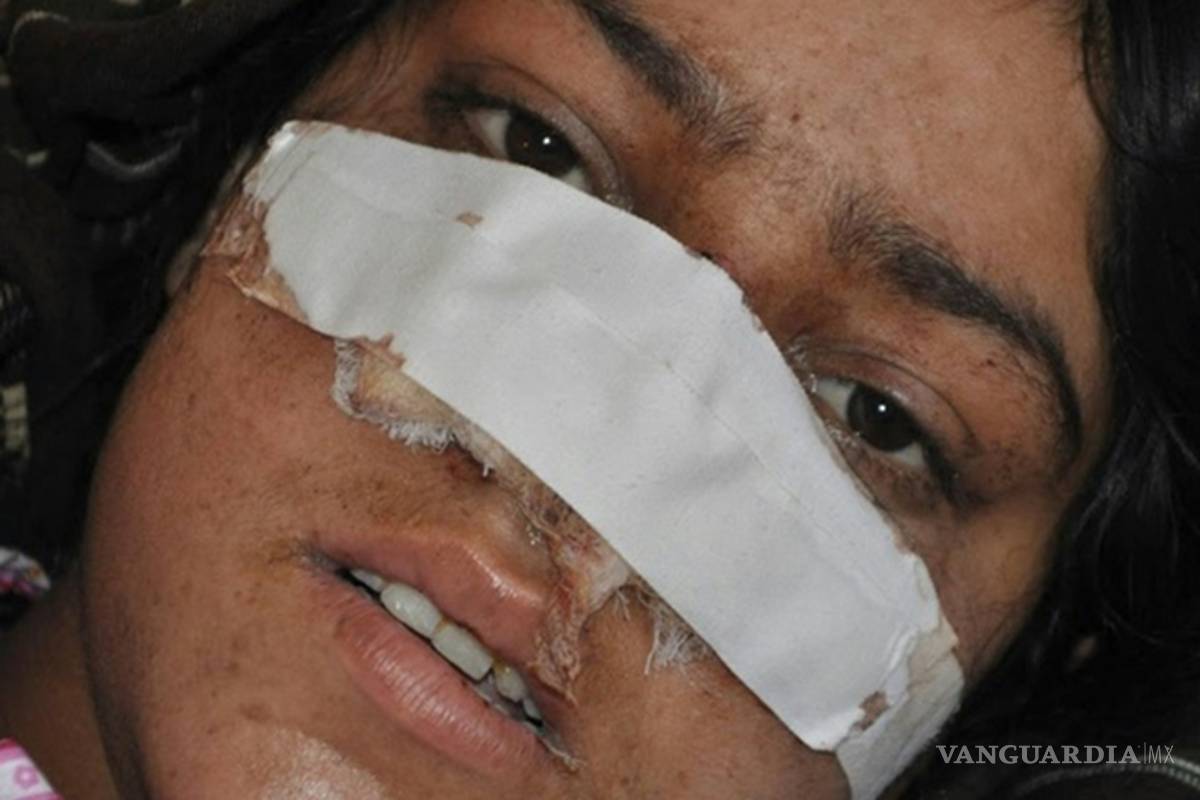 Hombre le corta la nariz a su esposa en Afganistán