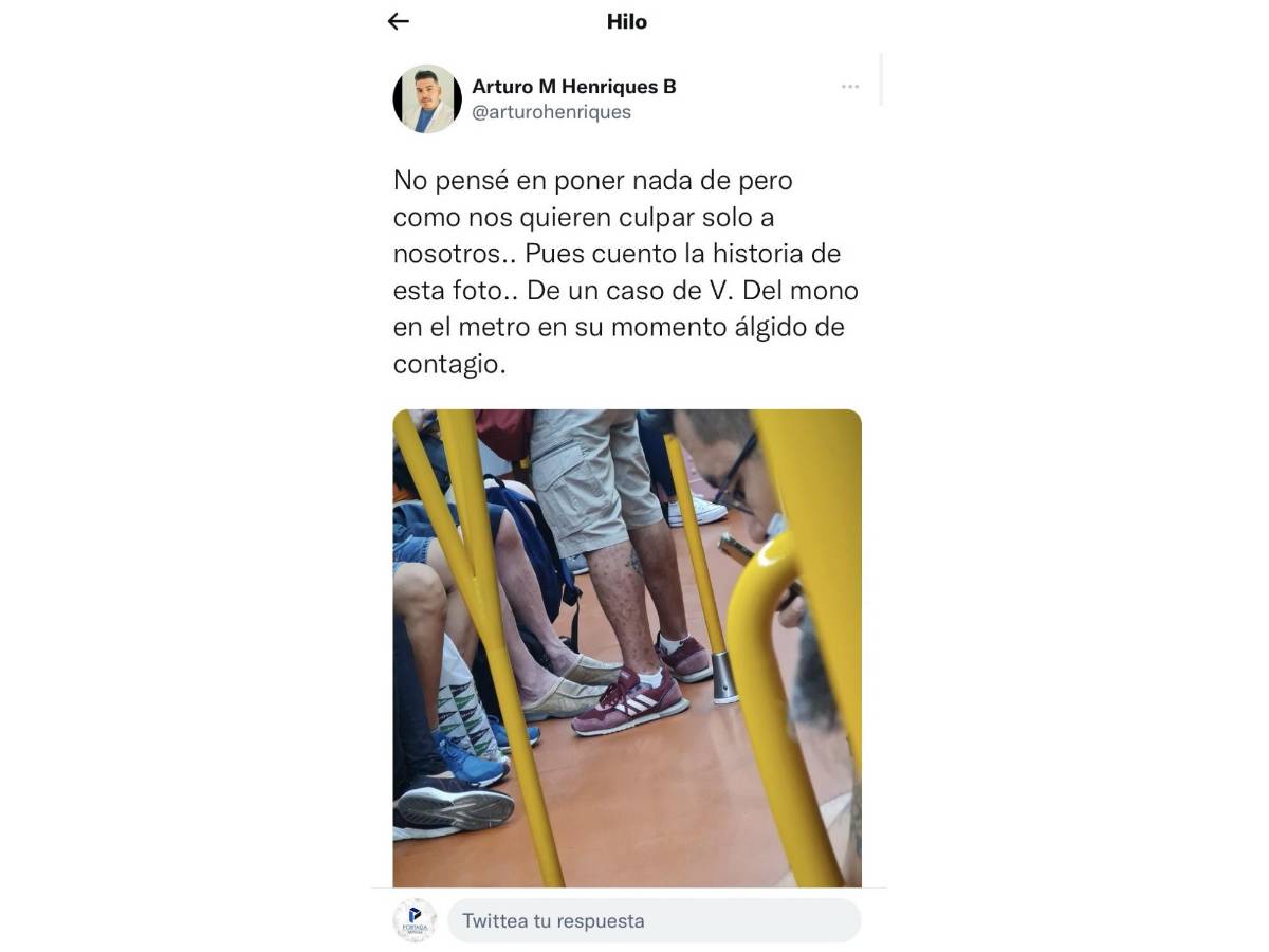 $!Un médico español reveló el caso del hombre infectado de viruela del mono que viajó por el Metro en dicho país