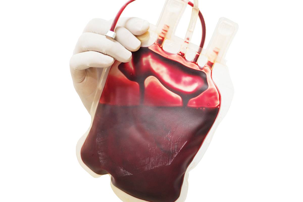 Sobrecarga de hierro